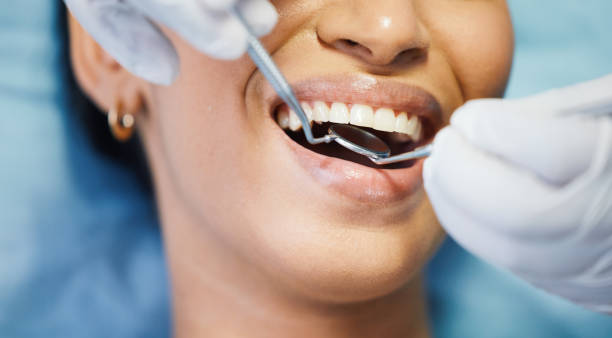 Our Range of Dental Services in San Antonio, FL